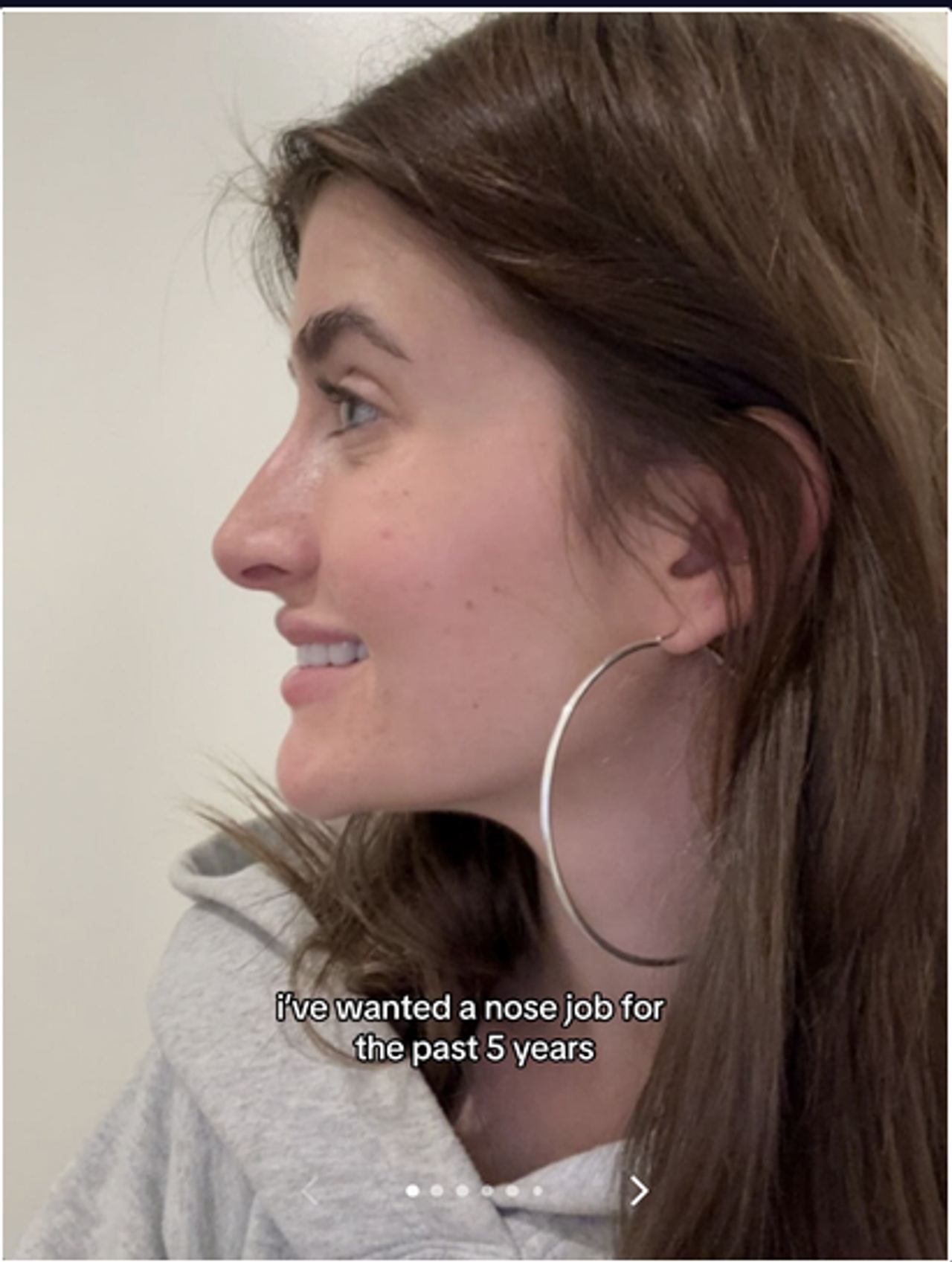 Sami Sheen shares her experience getting a nose job done, on a TikTok post dated August 13, 2024 | Source: Tiktok/@samisheen