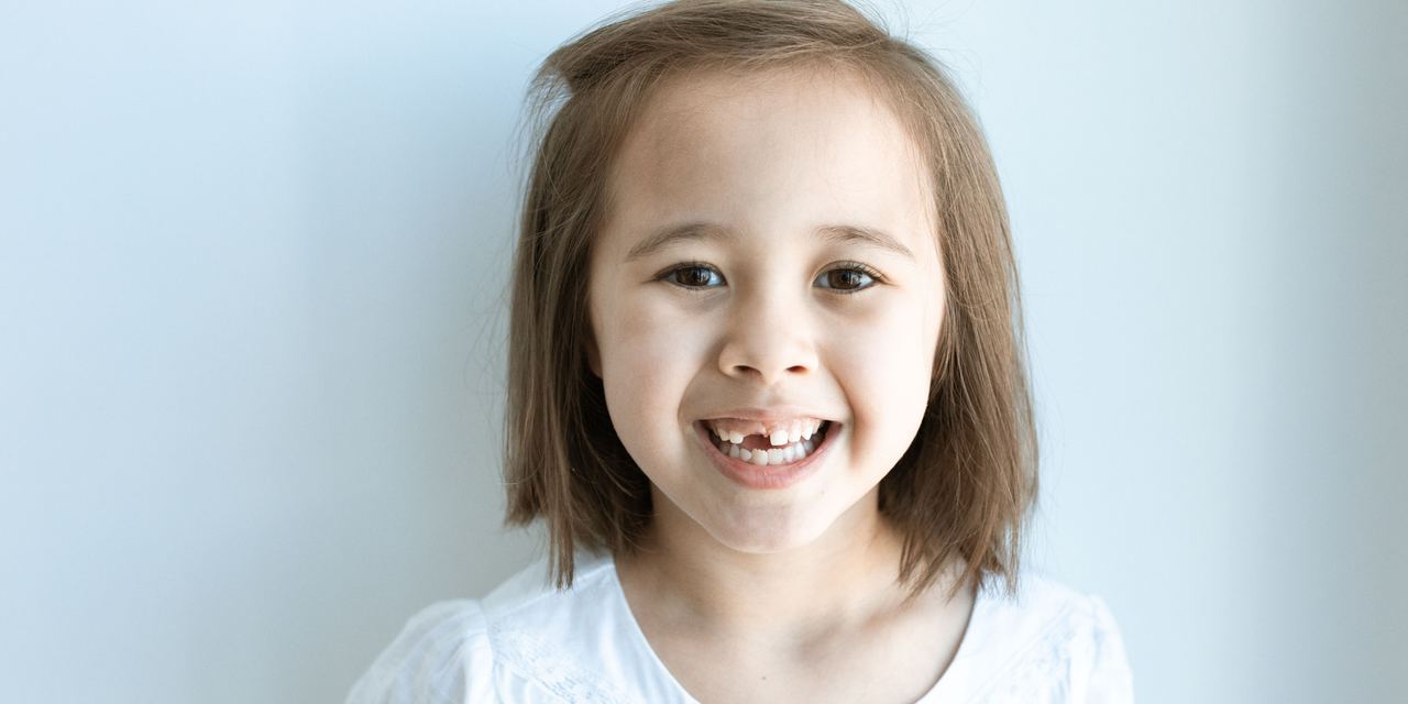 A child with missing teeth | Source: Pexels