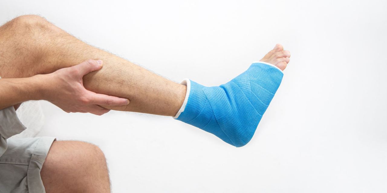 A man with a cast on his ankle | Source: Freepik