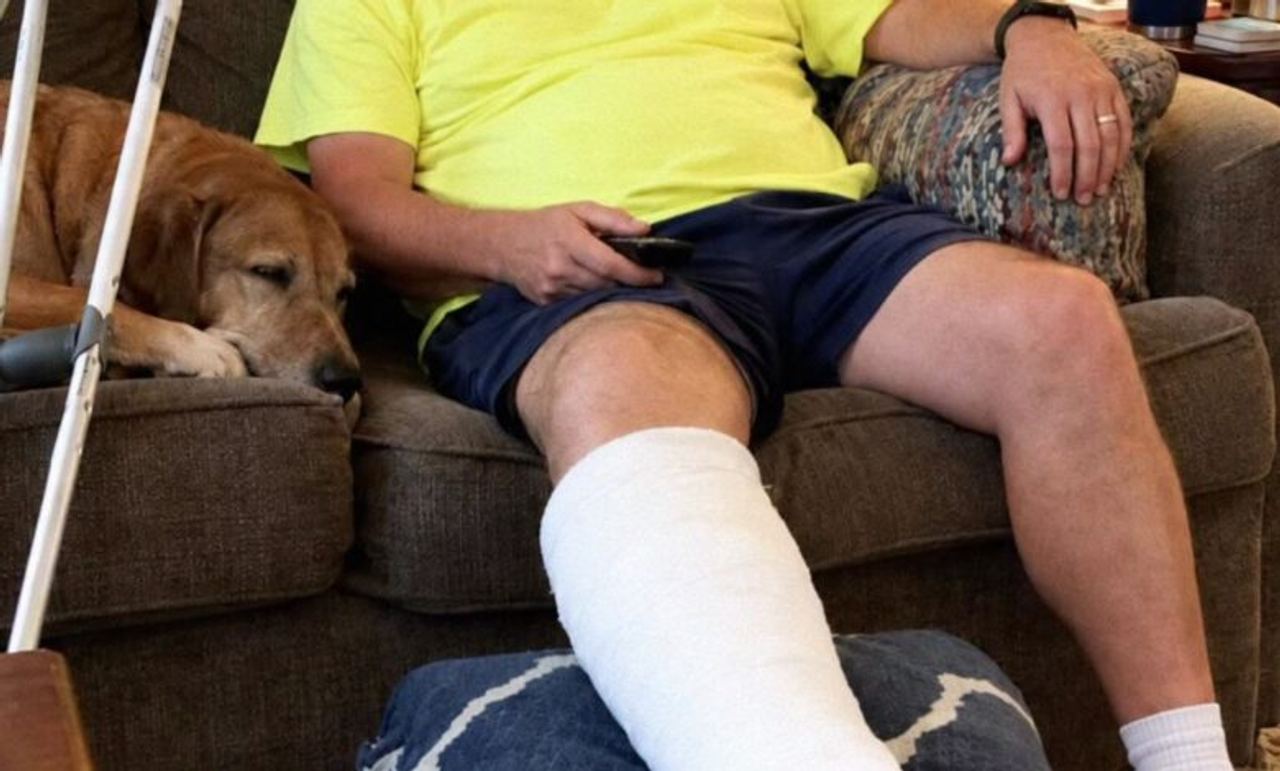 After 32 Years of Marriage, a Woman’s Husband Refused to Let Her Touch the Cast on His Right Leg – Then She Accidentally