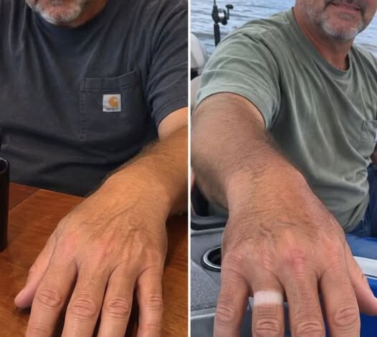 I Noticed a Fresh Ring Mark on My Husbands Finger After His Fishing Trip Then His Explanation Made Everything Worse
