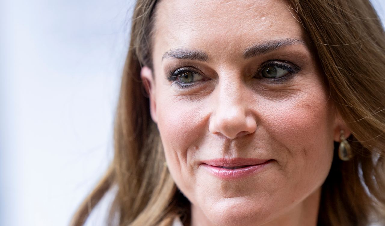 A close-up of Catherine from an earlier royal engagement shows the princess several months before her Leeds appearance. Recent photos prompted netizens to compare and comment on details of her appearance. | Source: Getty Images